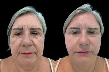 Sem-Título-1